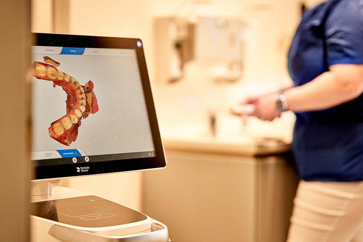 3D Bild eines Gebisses auf dem Bildschirm eines Computers, das bild wird vom Intraoralscanner generiert in der Kowadent-Zahnarztpraxis in Gerderath